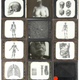 Illustration for article titled Own a Piece of Morbid Medical History